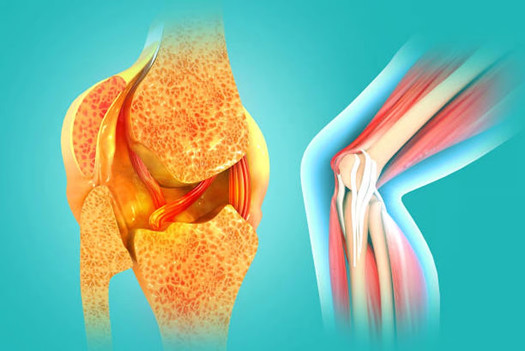 Arthritis pain will no longer bother you: Scientists' new 'smart gel' method