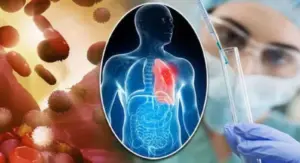 Cancer cases in delhi