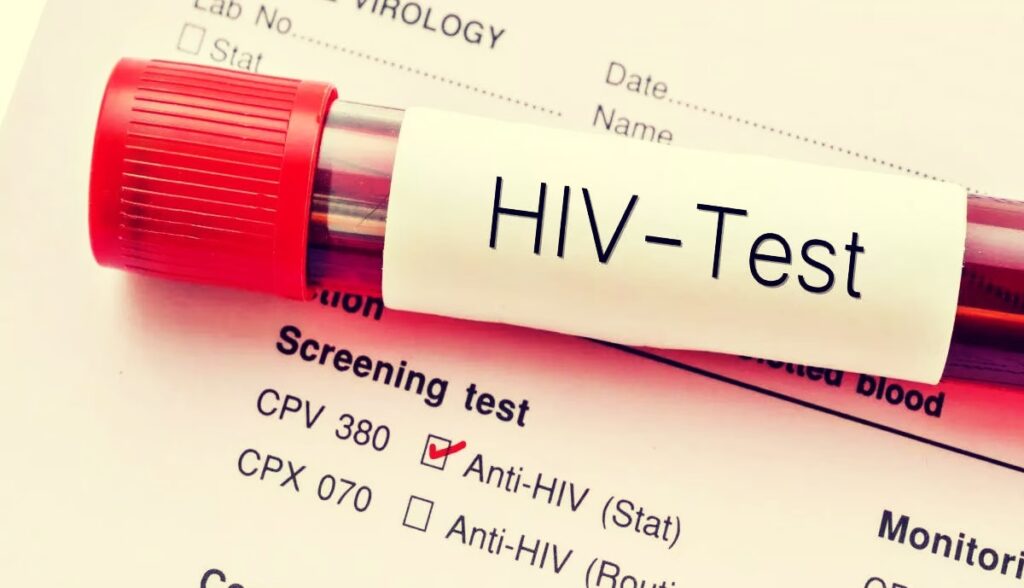 HIV-Test