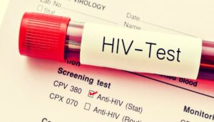 HIV-Test