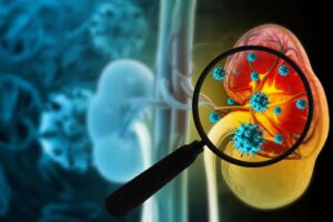 Kidney disease crisis worldwide